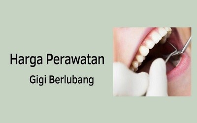 Harga Perawatan Gigi Berlubang Di Rs Klinik Puskesmas<script async src=